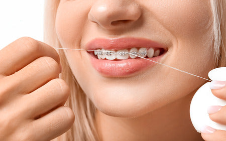 How to Floss with Braces