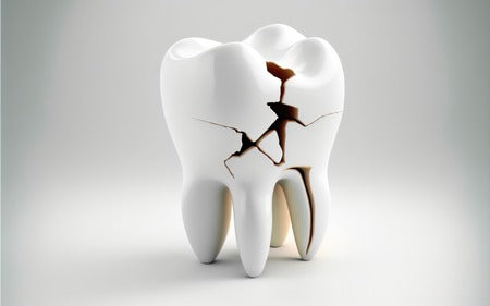 What Causes Teeth To Break