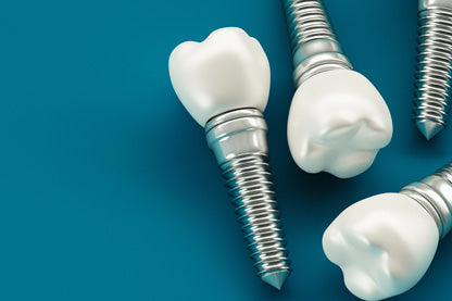 Dental Implant Procedure: What You Need to Know