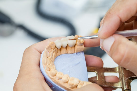 Understanding Dental Insurance - Part 3 (Major Services)