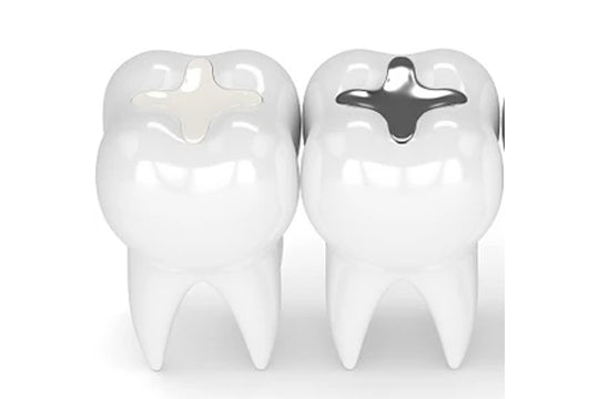 Understanding Dental Insurance - Part 2 (Basic Services)