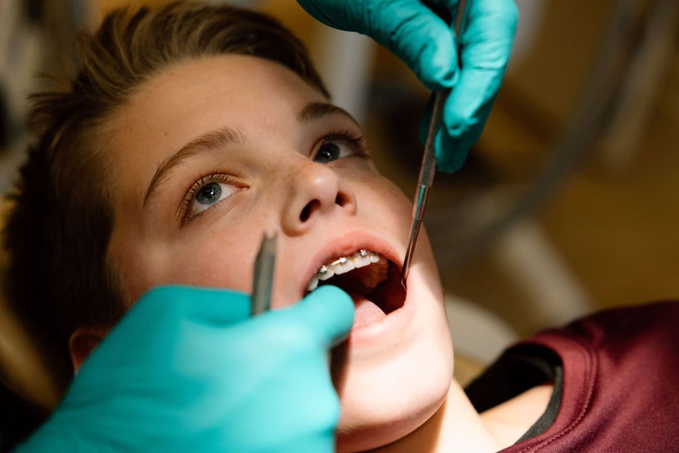 Dental Care for Children: Tips for Parents to Promote Healthy Habits
