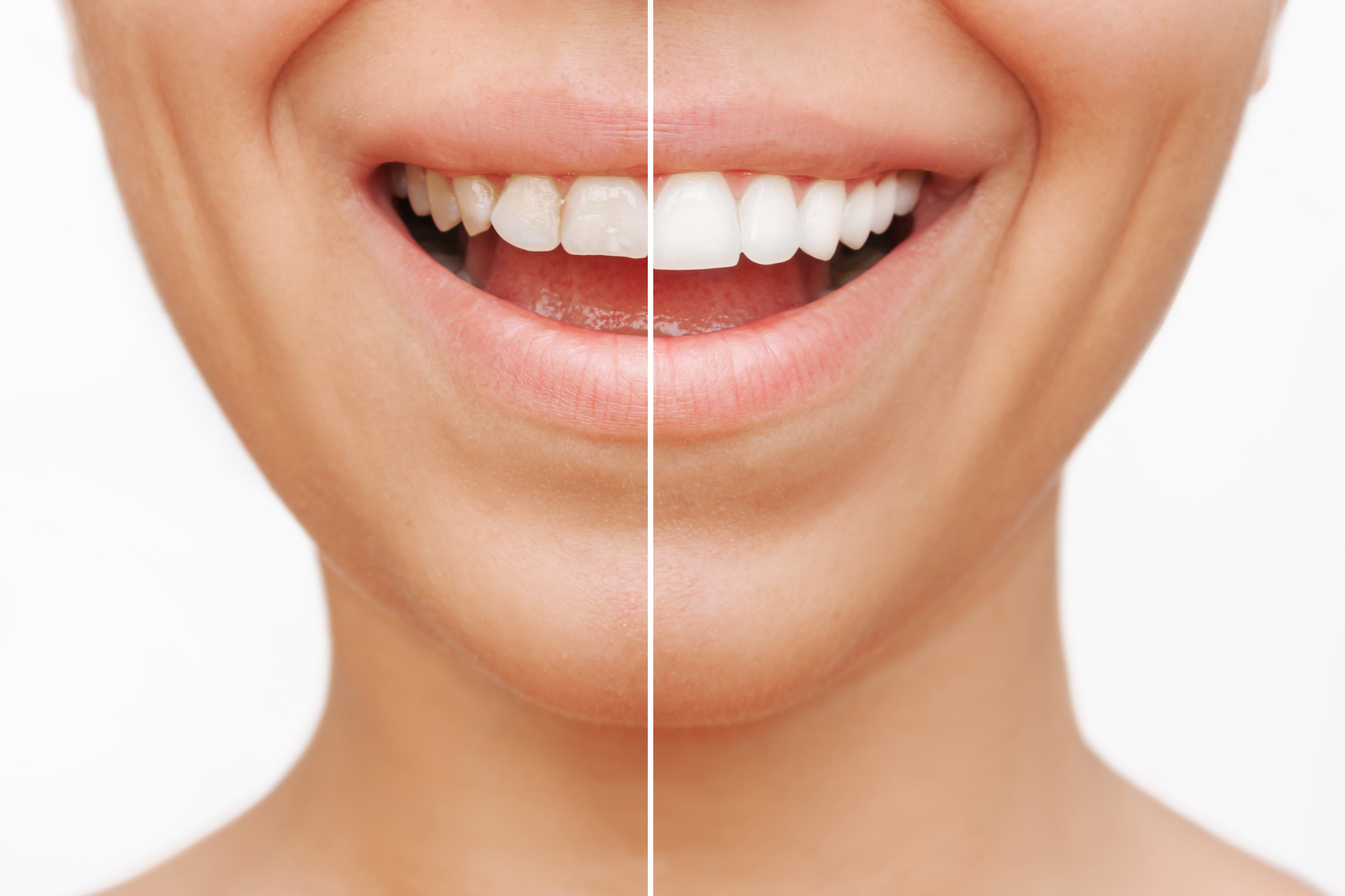What Is Cosmetic Dentistry?