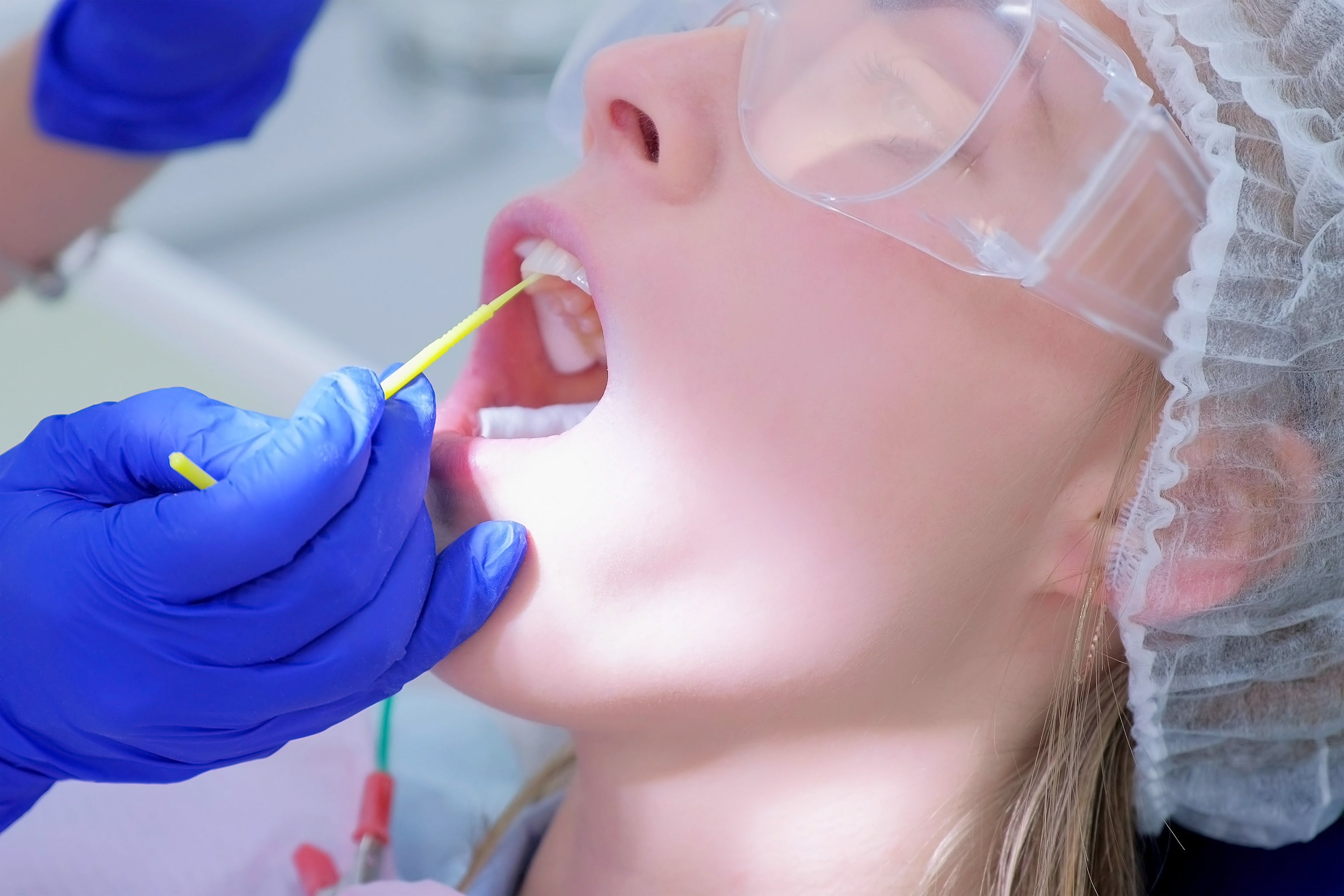 Do You Need Fluoride for Your Teeth?