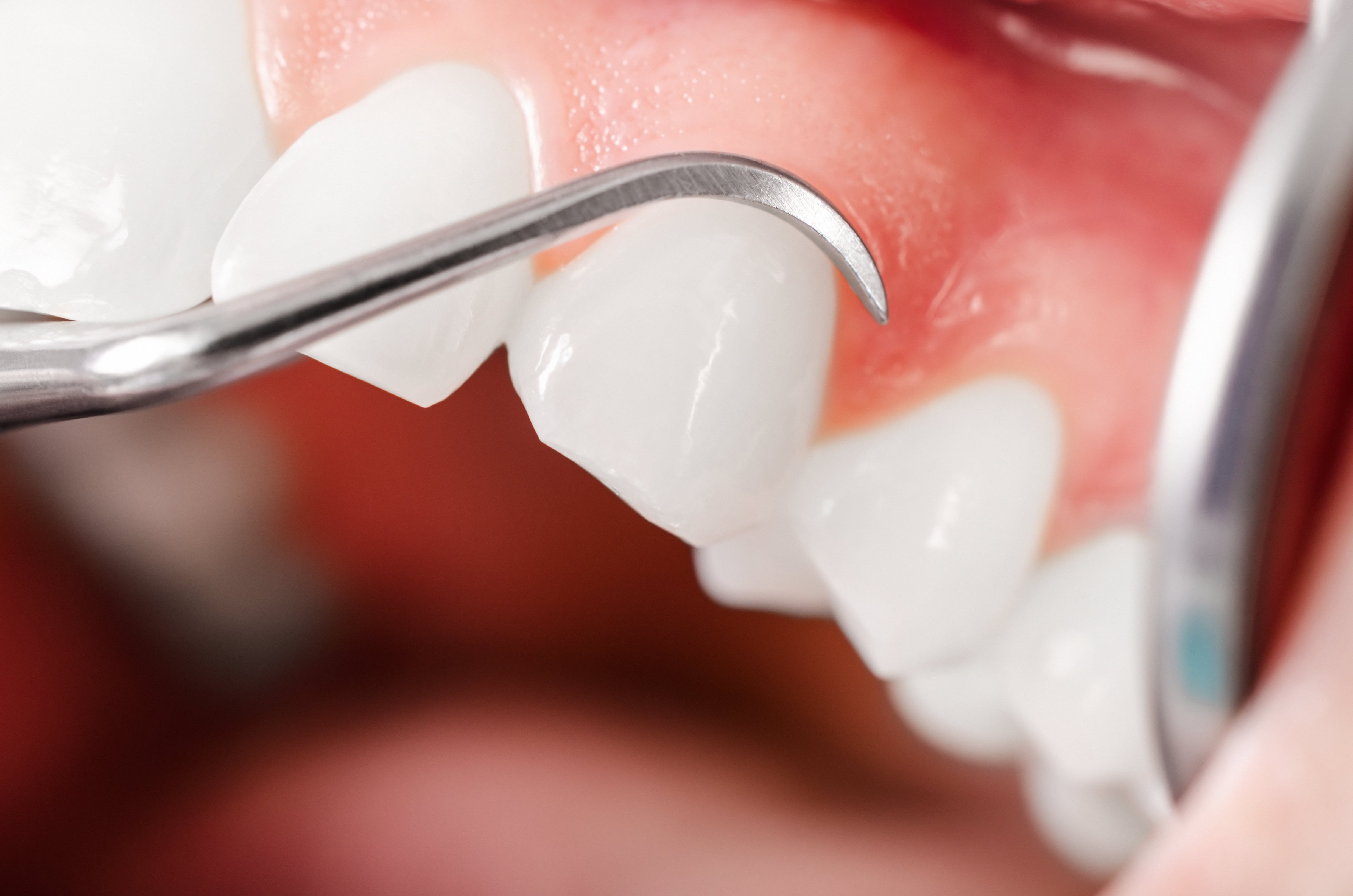 How to Have Better Gum Health