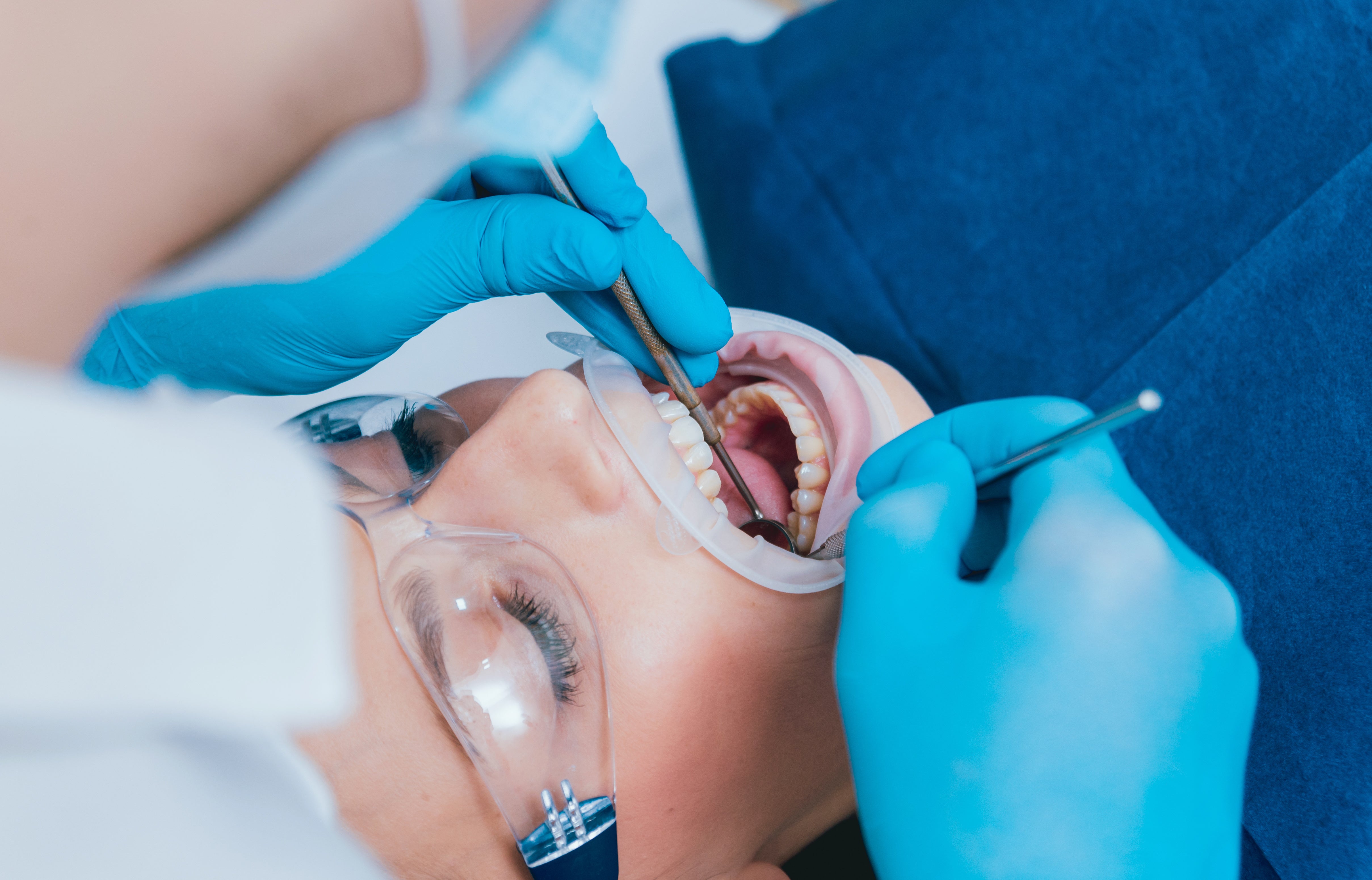 What Is a Scaling at the Dentist?