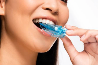 How to Clean Night Mouth Guard