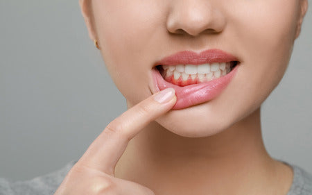 Understanding Gum Disease: Symptoms, Prevention, and Treatment