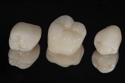 Dental Crowns: How Long Do They Last?