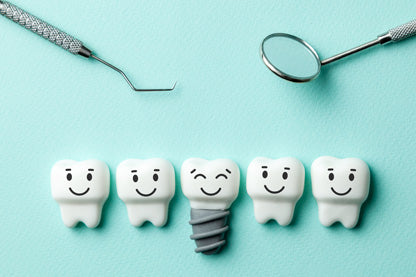 What Are Dental Implants: What You Need to Know