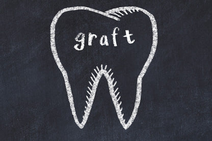 What Is a Bone Graft in Dentistry and Do I Need It?